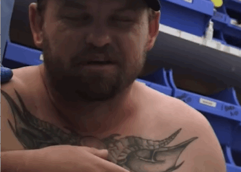 C1809003 He in pain injury has left lifeguards speechless_part2