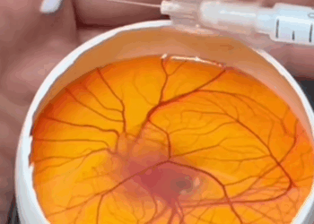 C2209009 Save duck egg_part2