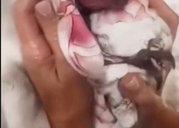 C1701024_baby kangaroo lives without its mother rest of its life.